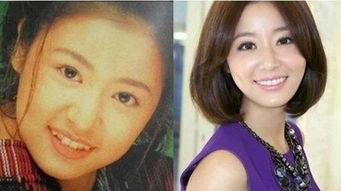 整牙吃瓜,揭秘明星吃瓜背后的美丽蜕变